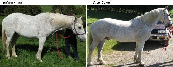 Before and After Bowen Therapy